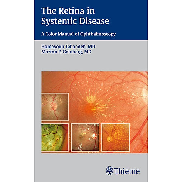 The Retina in Systemic Disease, Homayoun Tabandeh, Morton F. Goldberg