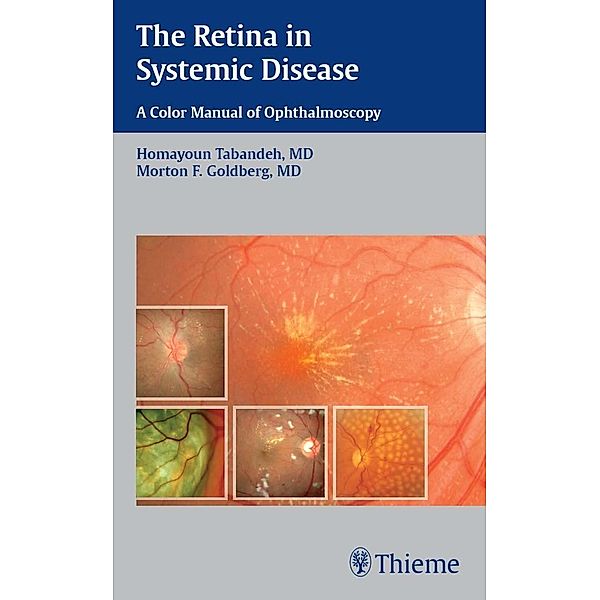 The Retina in Systemic Disease, Homayoun Tabandeh, Morton F. Goldberg