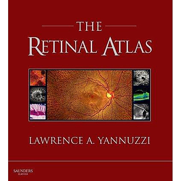 The Retinal Atlas E-Book, Lawrence A. Yannuzzi