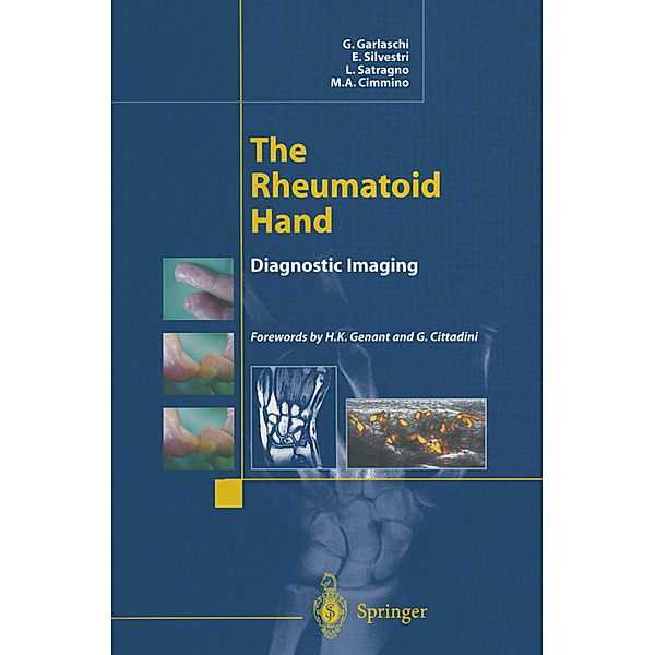 The Rheumatoid Hand, G. Garlaschi, E. Silvestri, L. Satragno, M. A. Cimmino