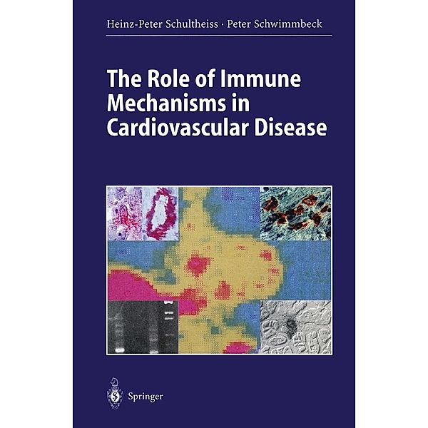 The Role of Immune Mechanisms in Cardiovascular Disease