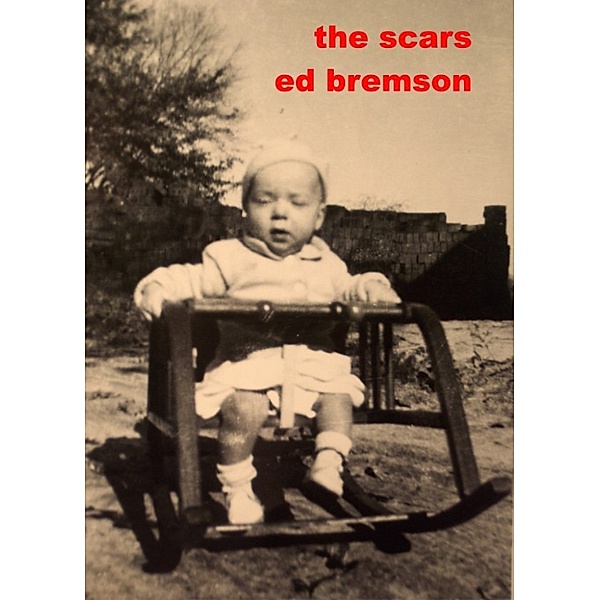 The Scars, Ed Bremson