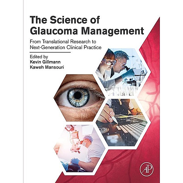 The Science of Glaucoma Management