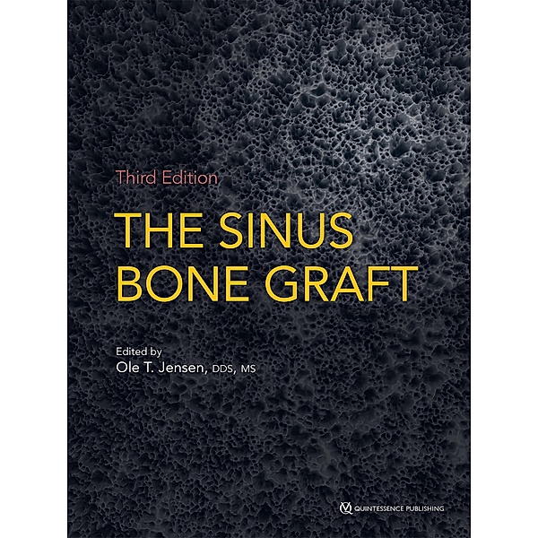 The Sinus Bone Graft / Third Edition Bd.3, Ole T. Jensen