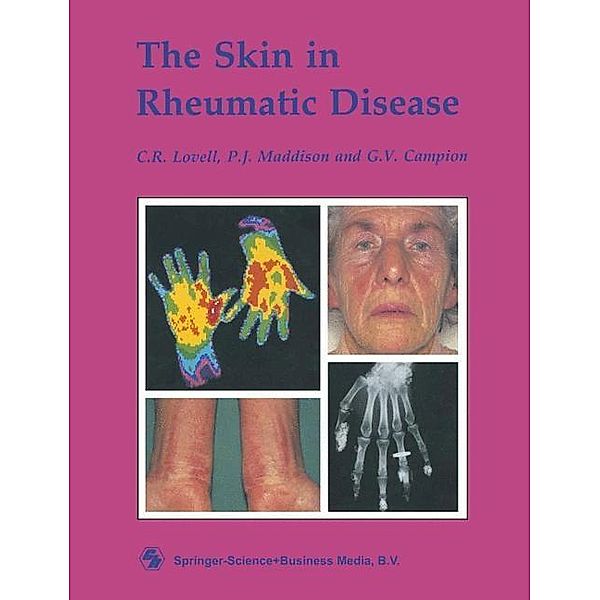 The Skin in Rheumatic Disease, C. R. Lovell, G. V. Campion, P. J. Maddison