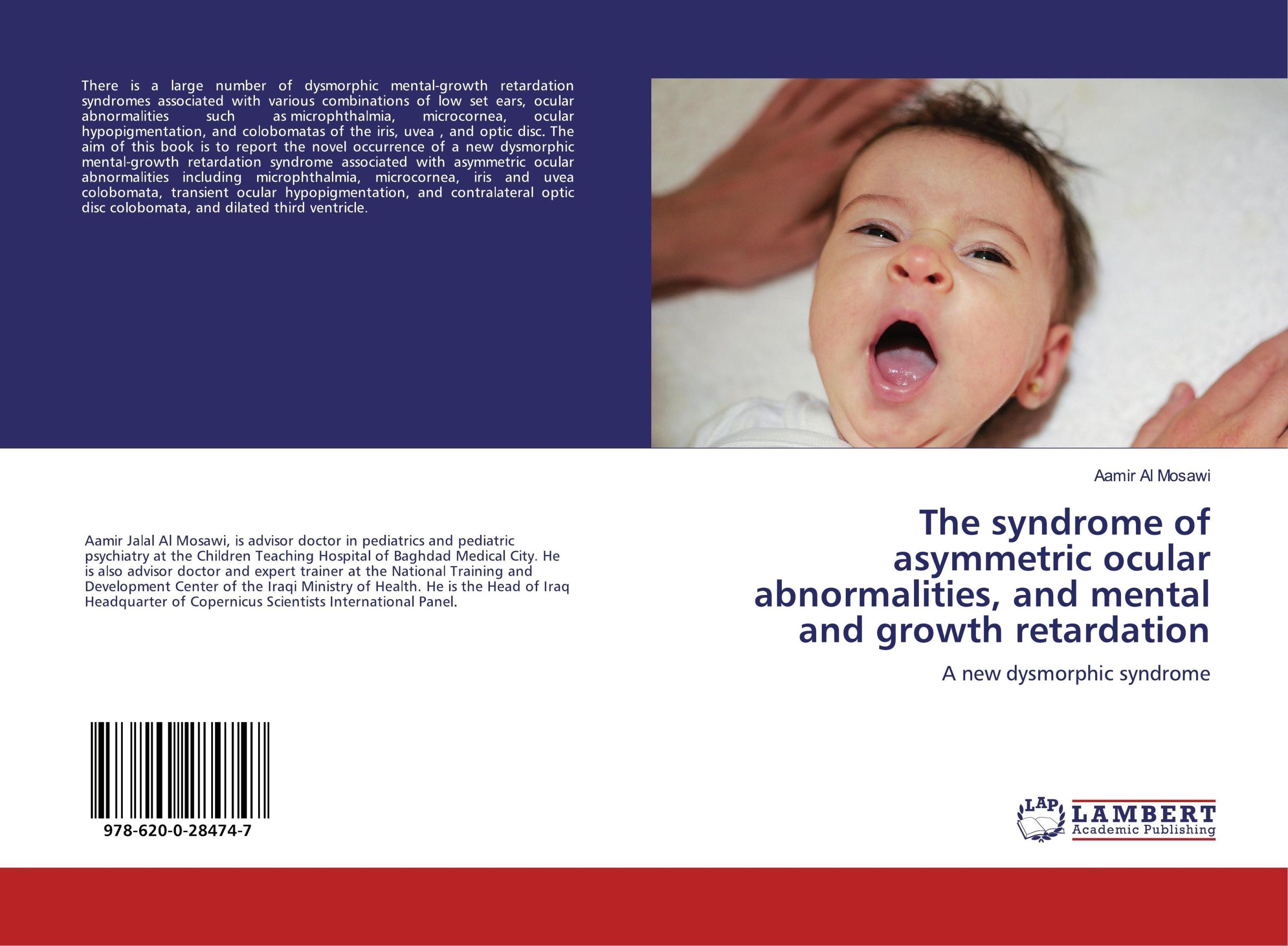 The syndrome of asymmetric ocular abnormalities, and mental and growth ...