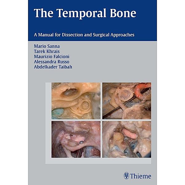 The Temporal Bone, Mario Sanna, Tarek Khrais, Maurizio Falcioni, Alessandra Russo, Abdelkader Taibah