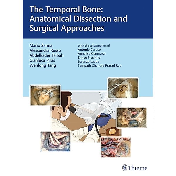 The Temporal Bone, Mario Sanna, Alessandra Russo, Abdelkader Taibah, Gianluca Piras, Wenlong Tang