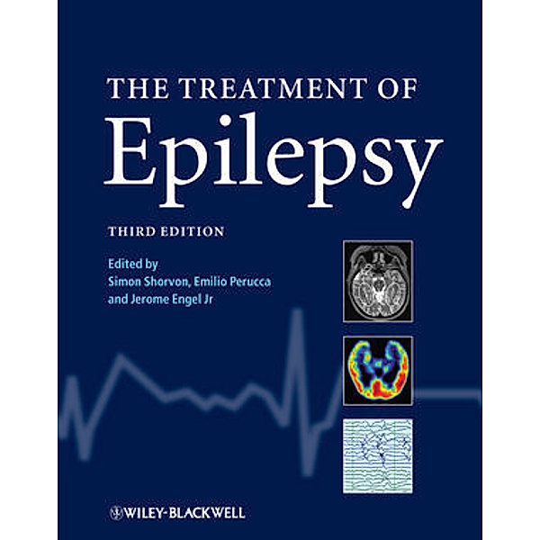 The Treatment of Epilepsy, Simon D. Shorvon