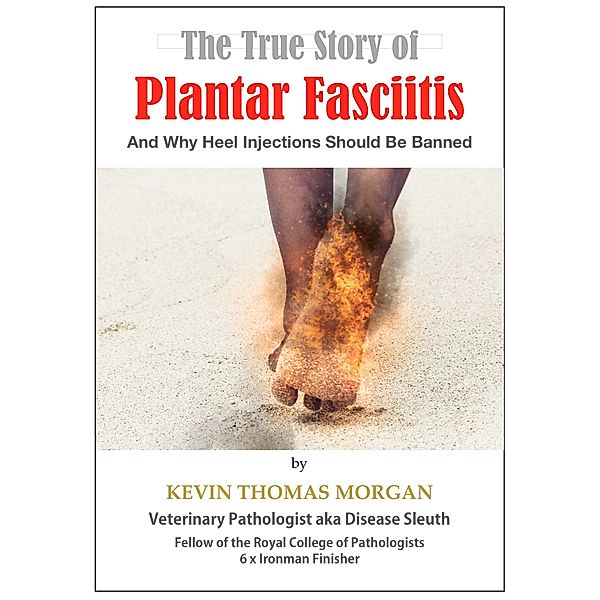 The True Story of Plantar Fasciitis: And Why Heel Injections Should Be Banned, Kevin Thomas Morgan