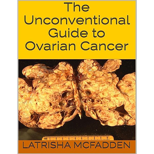 The Unconventional Guide to Ovarian Cancer, Latrisha McFadden