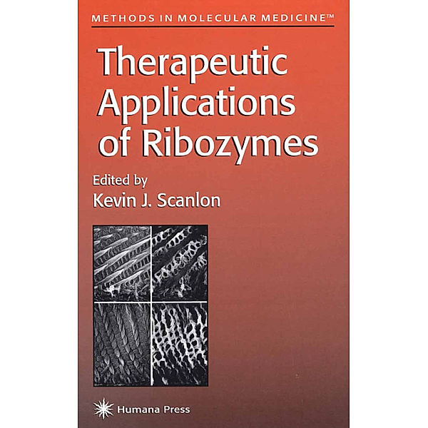 Therapeutic Applications of Ribozymes