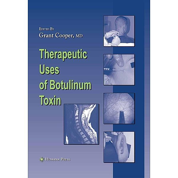 Therapeutic Uses of Botulinum Toxin / Musculoskeletal Medicine