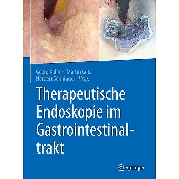 Therapeutische Endoskopie im Gastrointestinaltrakt