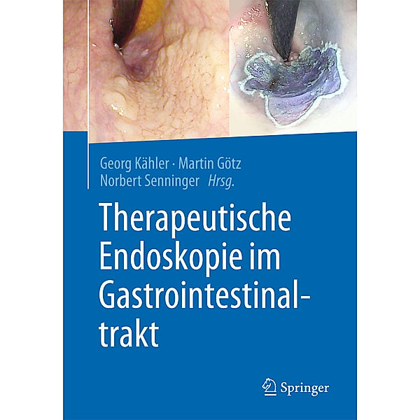 Therapeutische Endoskopie im Gastrointestinaltrakt