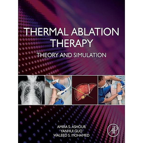 Thermal Ablation Therapy, Amira S. Ashour, Yanhui Guo, Waleed S. Mohamed