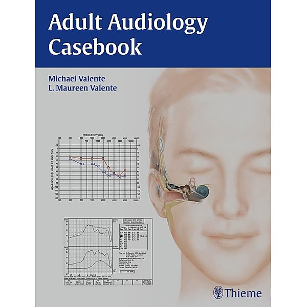 Thieme: Adult Audiology Casebook, L. Maureen Valente, Michael Valente