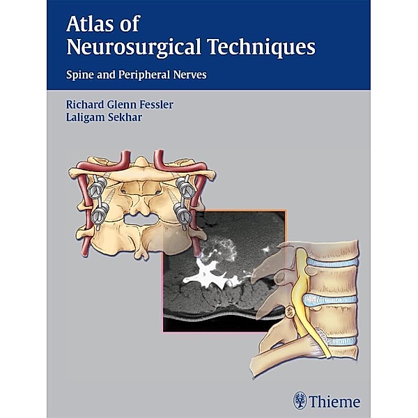 Thieme: Atlas of Neurosurgical Techniques