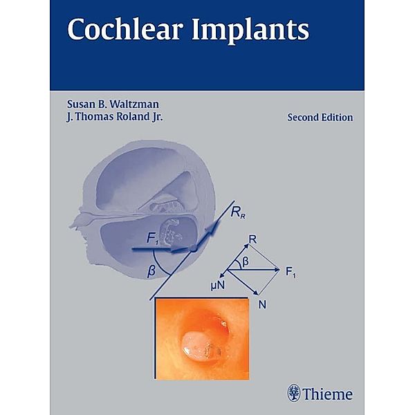 Thieme: Cochlear Implants
