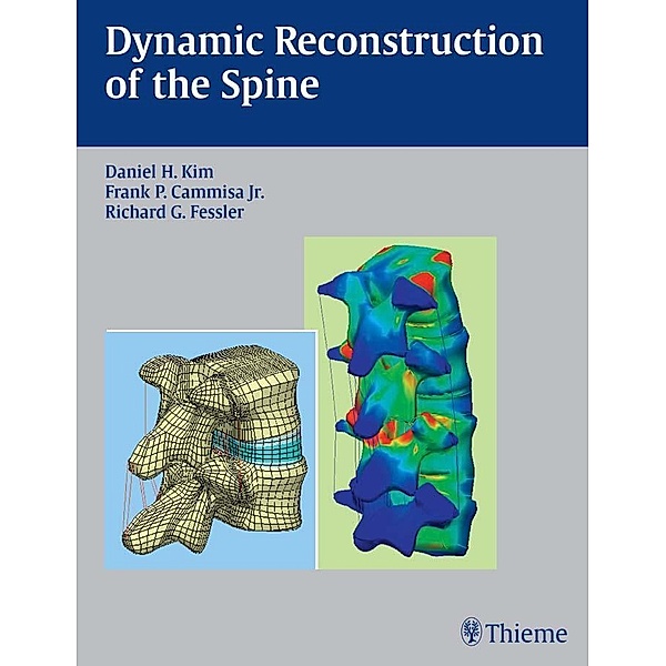 Thieme: Dynamic Reconstruction of the Spine