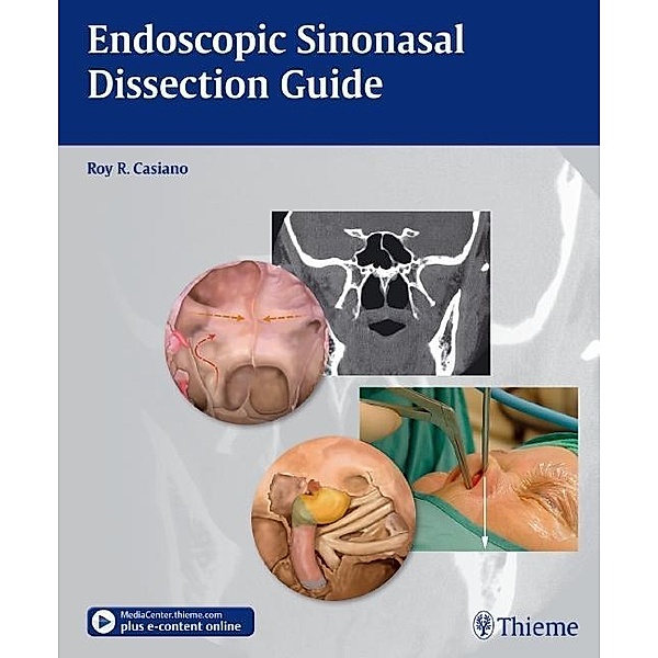 Thieme: Endoscopic Sinonasal Dissection Guide, Roy R. Casiano