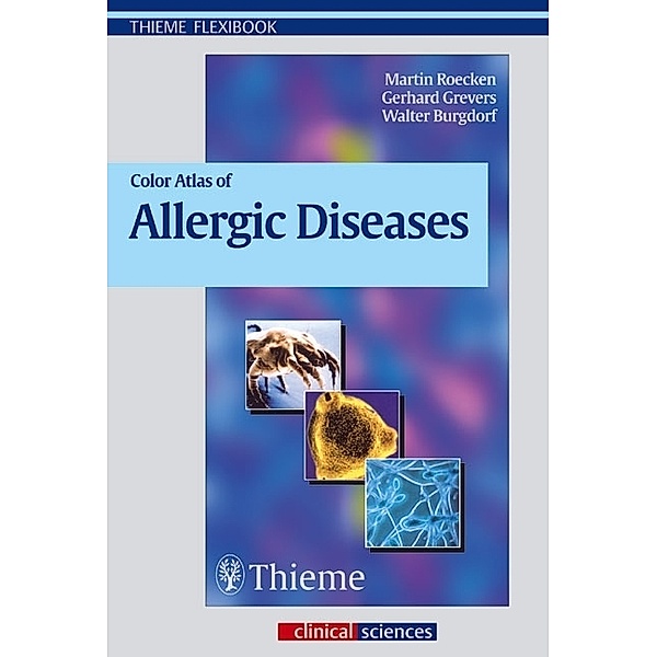 Thieme Flexibooks / Color Atlas of Allergic Diseases, Martin Röcken, Gerhard Grevers, Walter Burgdorf