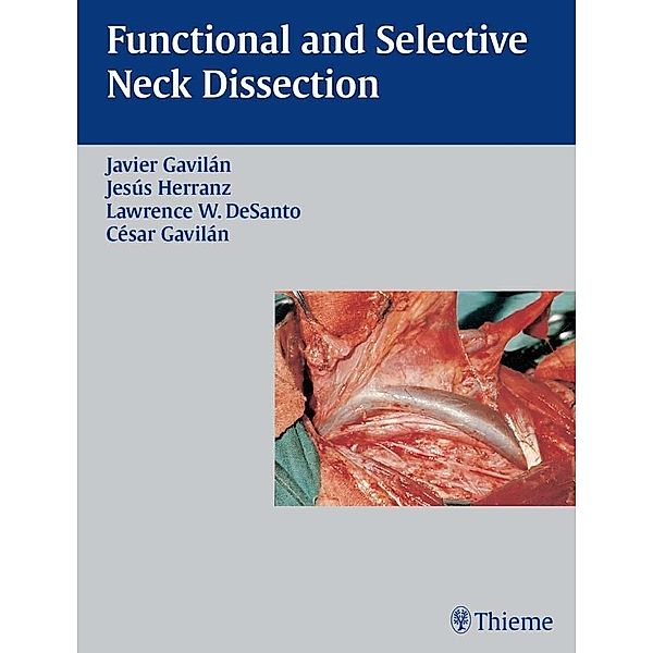 Thieme: Functional and Selective Neck Dissection, Lawrence W. DeSanto, Javier Gavilan, Jesus Herranz