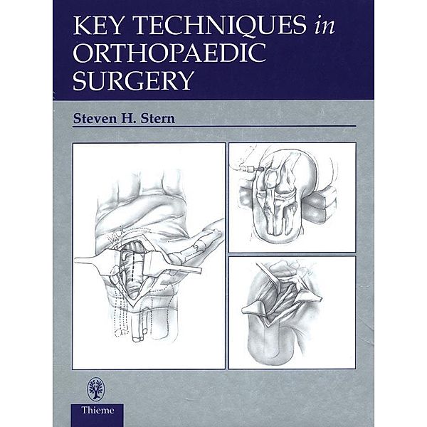 Thieme: Key Techniques in Orthopaedic Surgery, Steven H. Stern