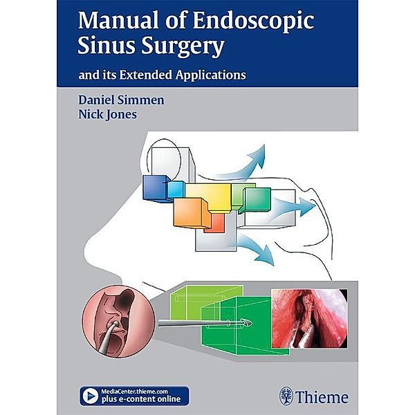 Thieme: Manual of Endoscopic Sinus Surgery, Daniel Simmen, Nick S. Jones