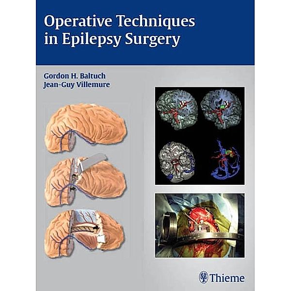 Thieme: Operative Techniques in Epilepsy Surgery
