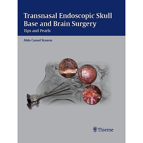 Thieme: Transnasal Endoscopic Skull Base and Brain Surgery