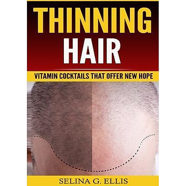 Thinning Hair / Urgesta AS, Selina Ellis