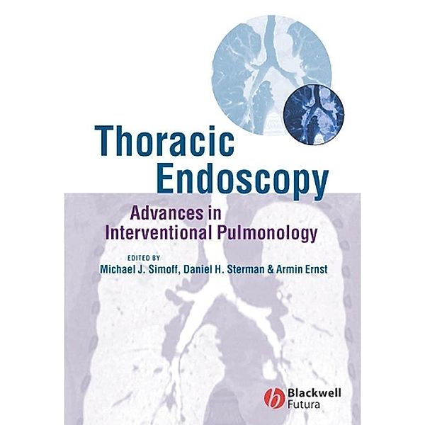 Thoracic Endoscopy