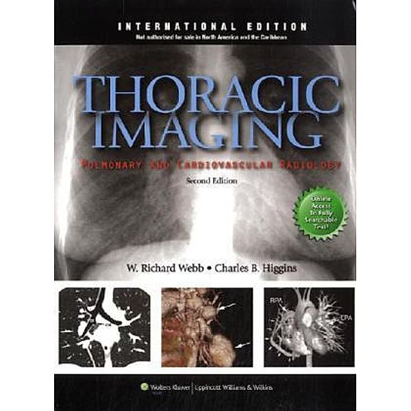 Thoracic Imaging, W. Richard Webb, Charles B. Higgins