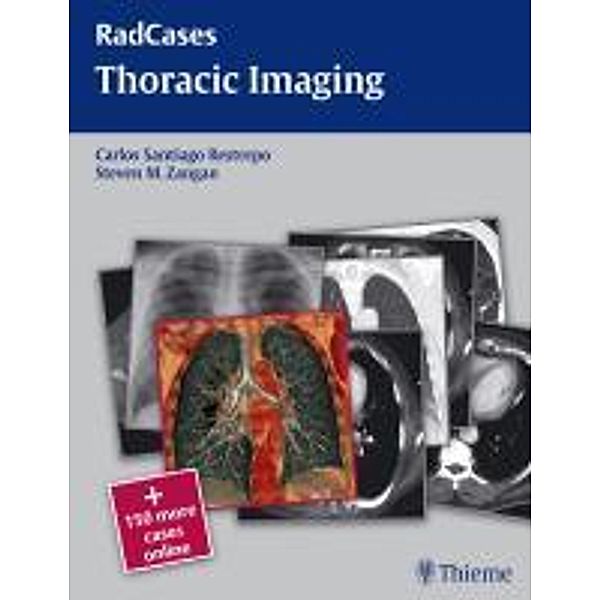 Thoracic Imaging, Steven M. Zangan, Carlo Santiago Restrepo