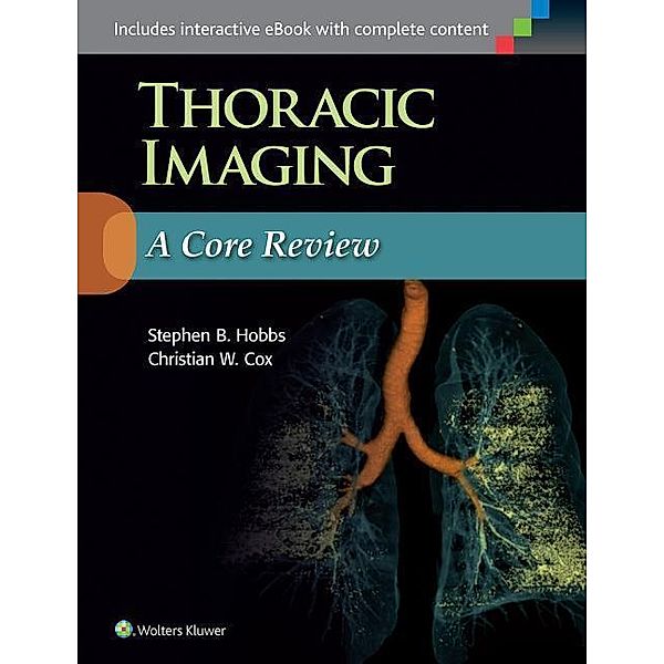 Thoracic Imaging, Stephen Hobbs, Christian W. Cox