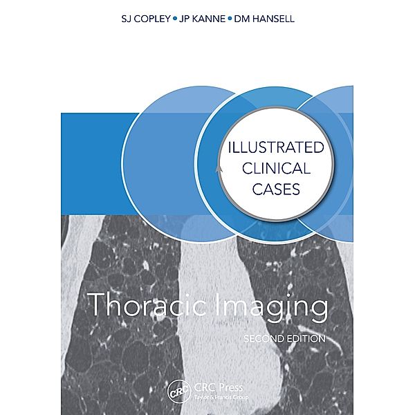 Thoracic Imaging, Sue Copley, David Hansell, Jeffrey Kanne