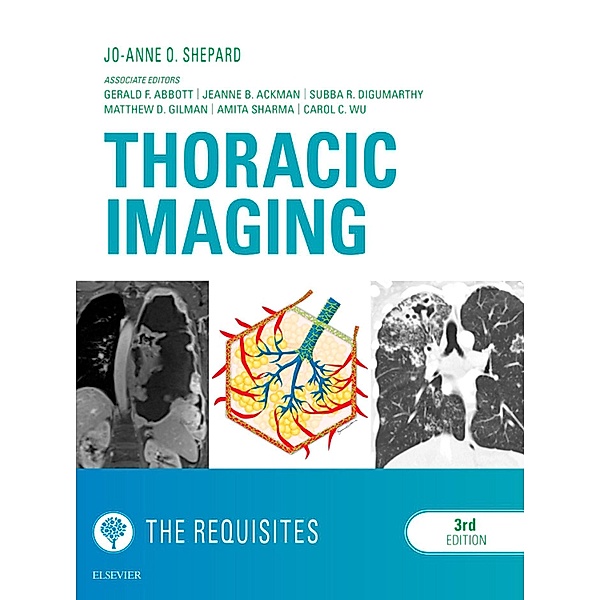 Thoracic Imaging The Requisites E-Book, Jo-Anne O Shepard
