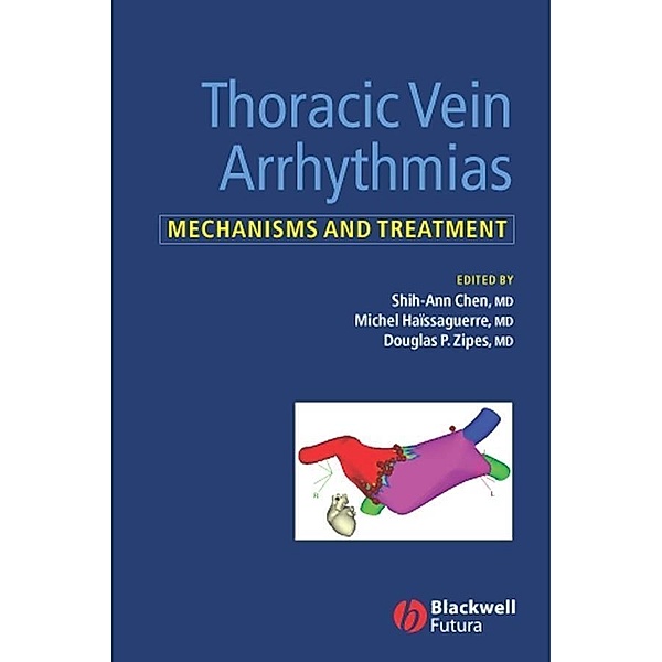 Thoracic Vein Arrhythmias