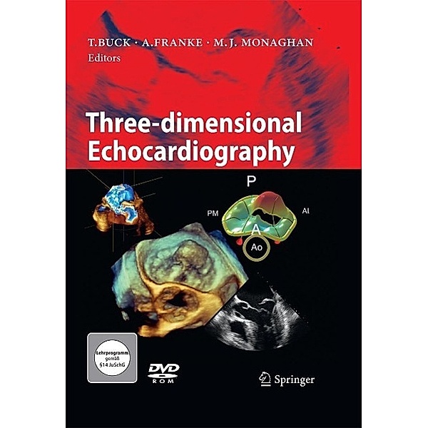 Three-dimensional Echocardiography, Andreas Franke, Thomas Buck