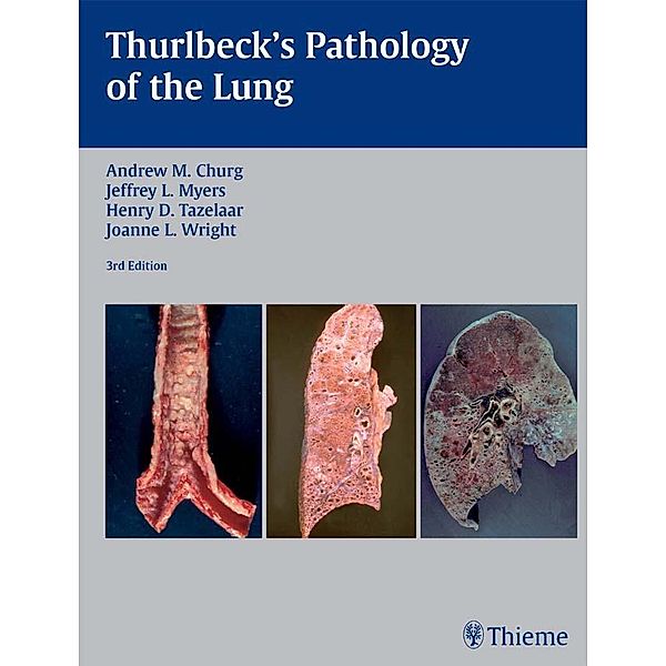 Thurlbeck's Pathology of the Lung, Andrew M. Churg, Jeffrey L. Myers, Henry D. Tazelaar, Joanne L. Wright