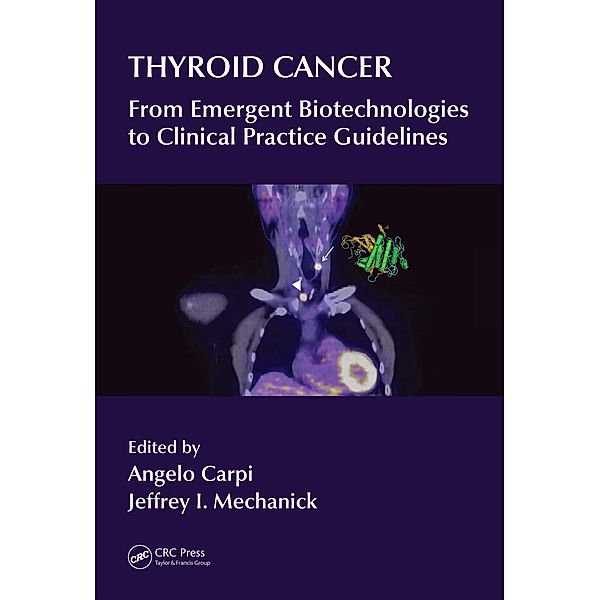 Thyroid Cancer