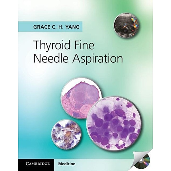 Thyroid Fine Needle Aspiration, Grace C. H. Yang