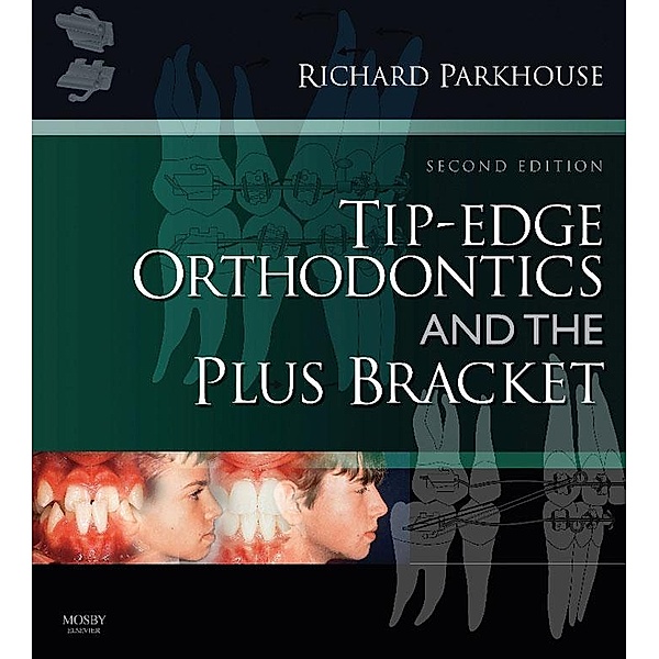 Tip-Edge Orthodontics and the Plus Bracket, Richard Parkhouse