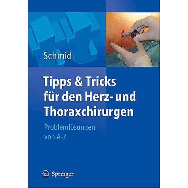 Tipps und Tricks für den Herz- und Thoraxchirurgen / Tipps und Tricks, Christof Schmid