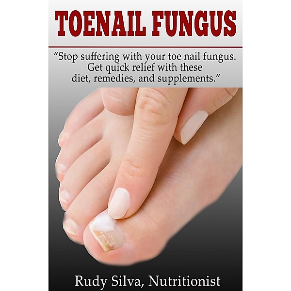 Toe Nail Fungus (Nutritional) / Nutritional, Rudy Silva