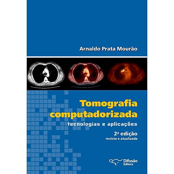 Tomografia computadorizada, Arnaldo Prata Mourão