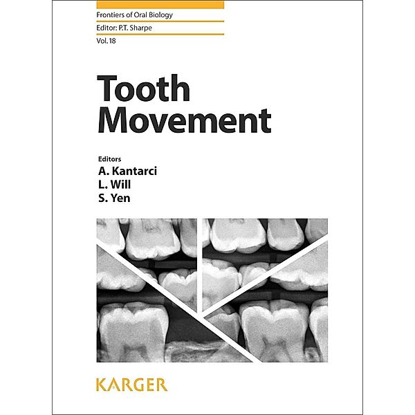 Tooth Movement