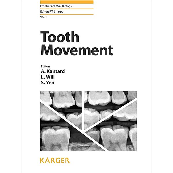 Tooth Movement