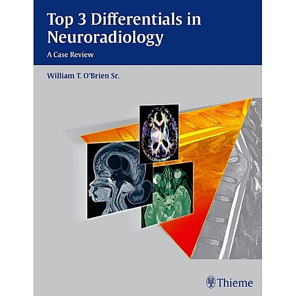 Top 3 Differentials in Neuroradiology, William T. O'Brien